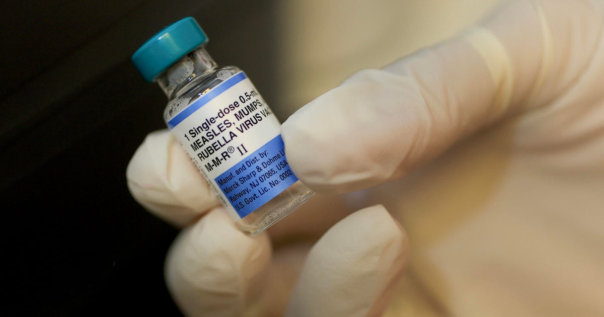 cbsn fusion breaking down new cdc recommendation on mmrv vaccine thumbnail