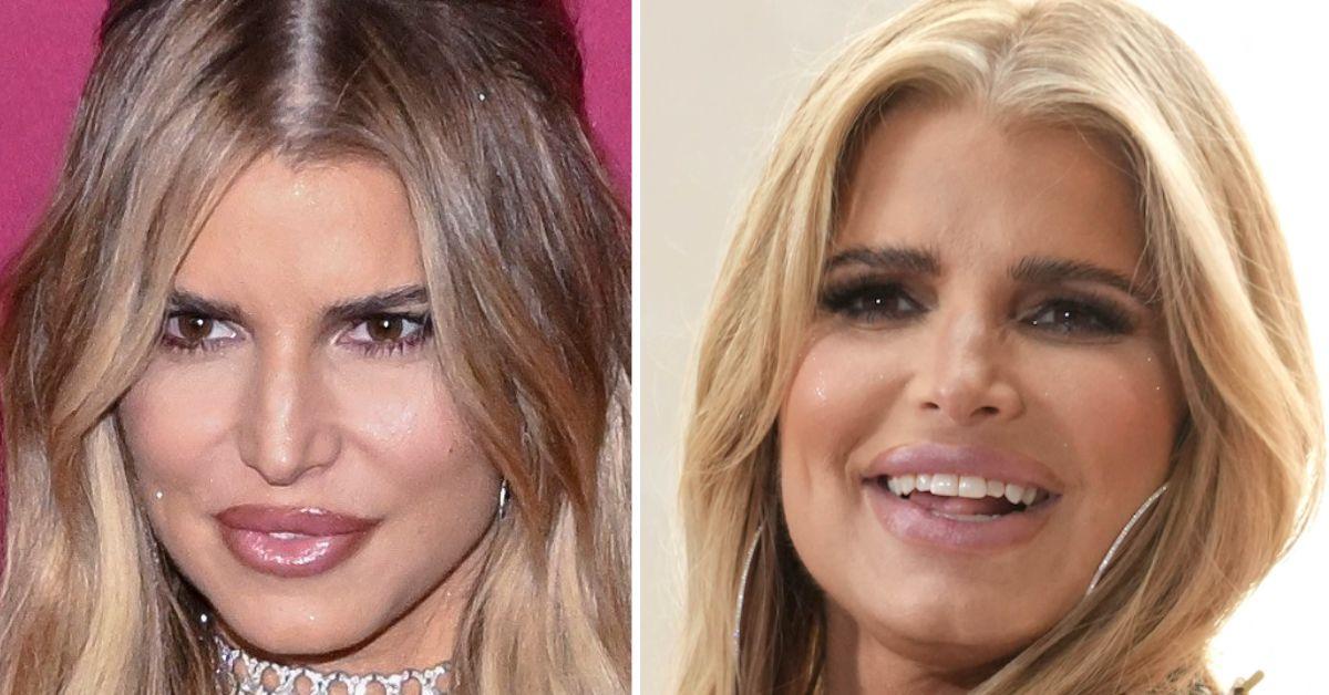jessica simpson plastic surgery disaster 1761345184720
